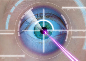 Rashmi Akshikar - Laser treatments
